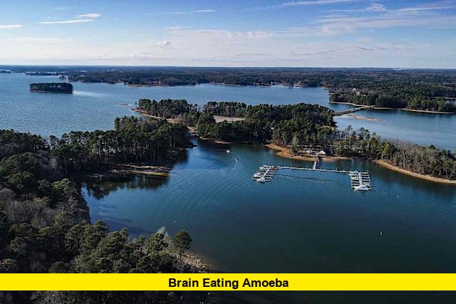 Brain Eating Amoeba