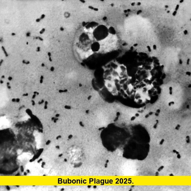 Bubonic Plague 2025. Bubonic Plague 2025