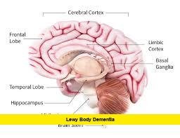 Lewy Body Dementia