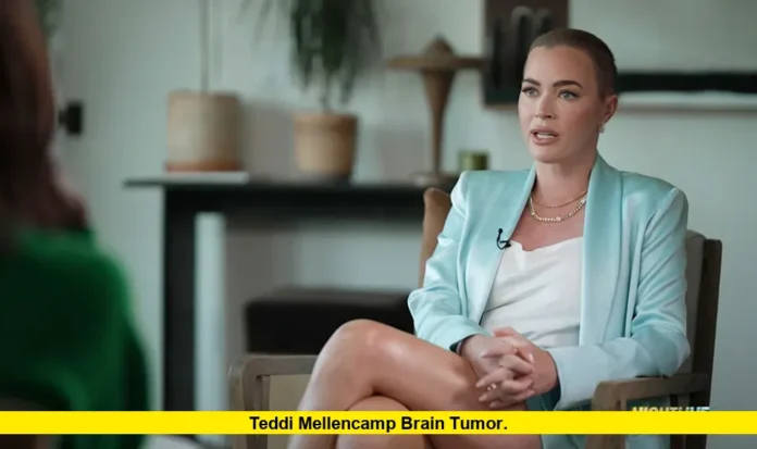 Teddi Mellencamp Brain Tumor