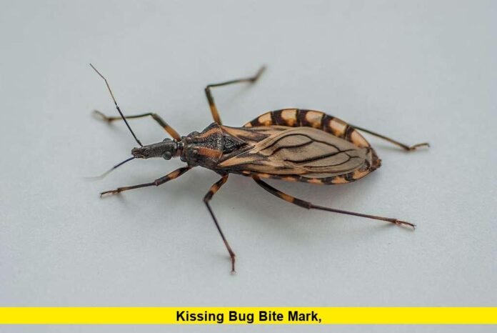 Kissing Bug Bite Mark, Kissing Bug Bite Mark