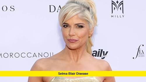 Selma Blair Disease