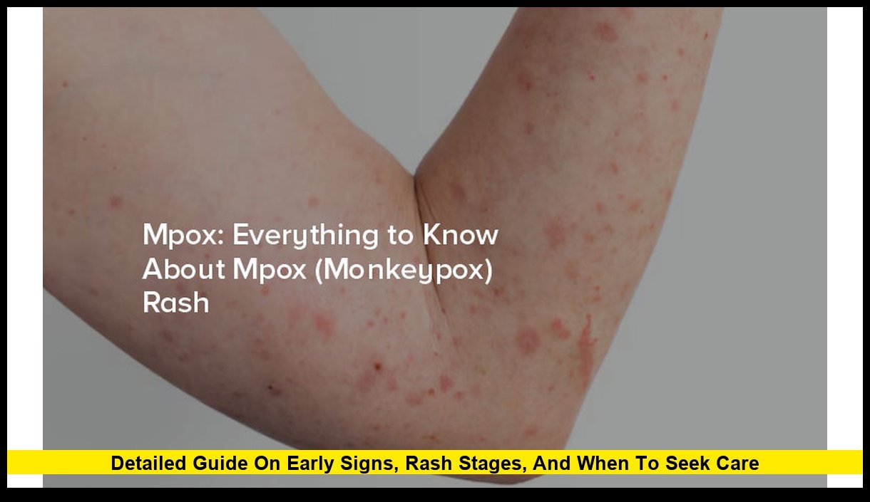 Mpox Symptoms: Detailed Guide on Early Signs, Rash Stages, and When to ...