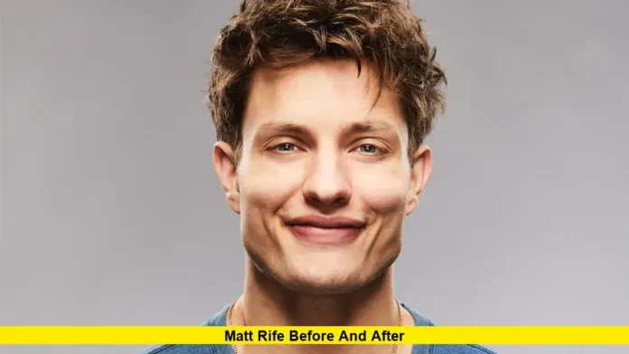 Matt Rife Before and After Matt Rife Before and After