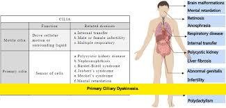Primary Ciliary Dyskinesia