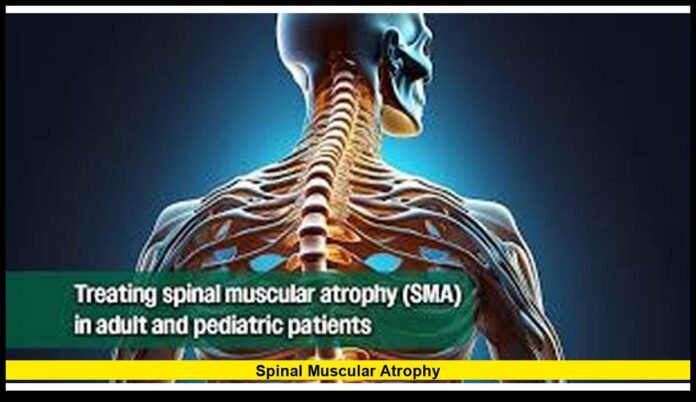Spinal muscular atrophy