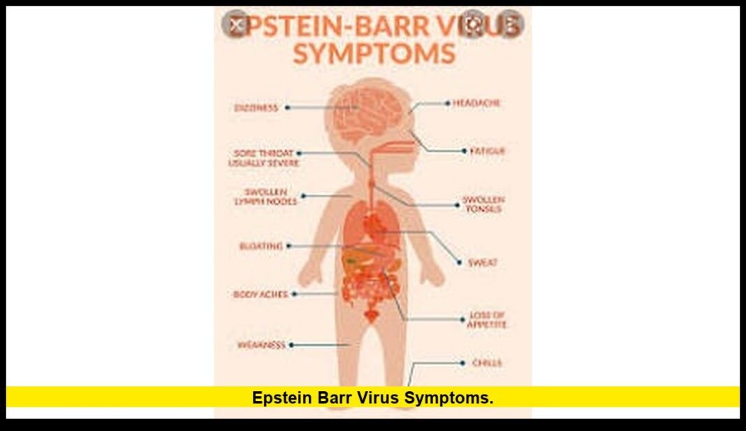 Epstein Barr Virus Symptoms: Latest Medical Understanding, Early ...