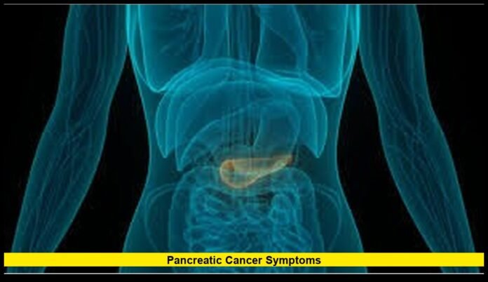 Pancreatic cancer symptoms Pancreatic cancer symptoms