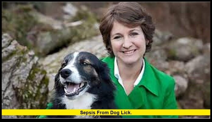 Sepsis from dog lick.