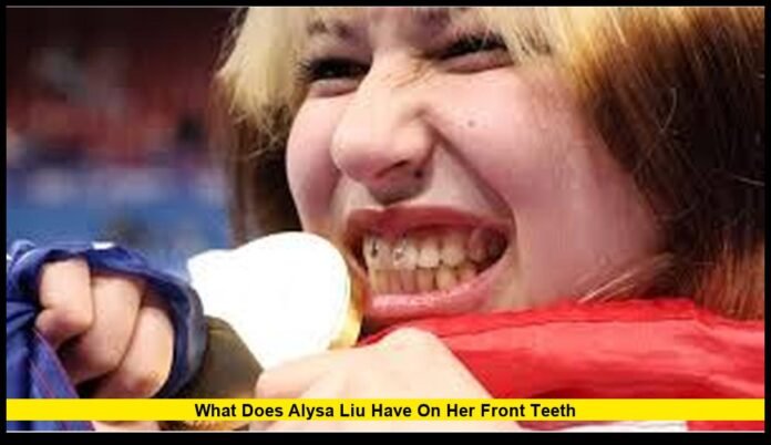 what does alysa liu have on her front teeth