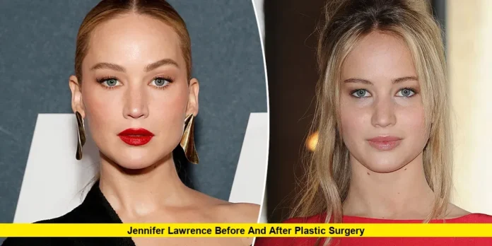 Jennifer Lawrence Before and After Plastic Surgery