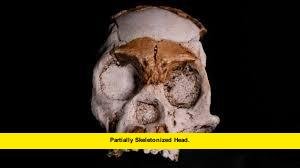 Partially Skeletonized Head