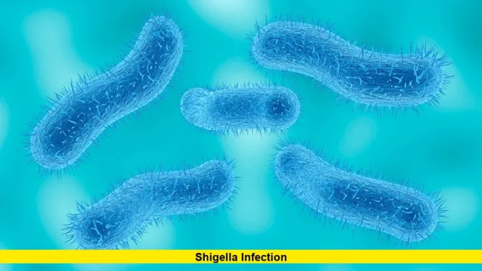 Shigella Infection
