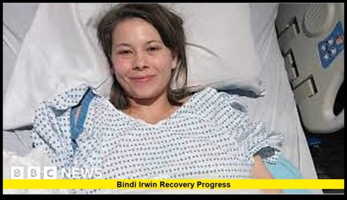 Bindi Irwin recovery progress