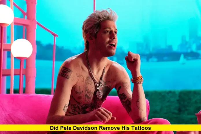 Did Pete Davidson Remove His Tattoos