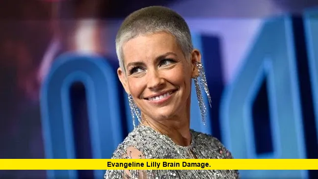 Evangeline Lilly Brain Damage