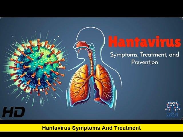 Hantavirus Symptoms and Treatment