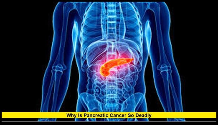 Why is pancreatic cancer so deadly