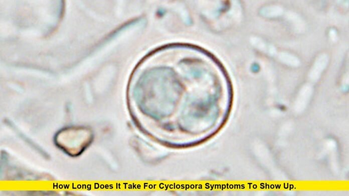 How Long Does It Take for Cyclospora Symptoms to Show Up. How Long Does It Take for Cyclospora Symptoms to Show Up