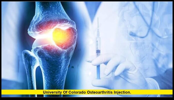 University of Colorado osteoarthritis injection. University of Colorado osteoarthritis injection.