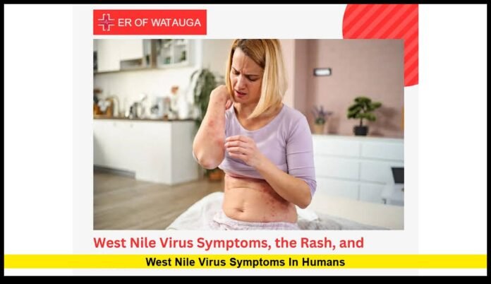 West Nile virus symptoms in humans West Nile virus symptoms in humans