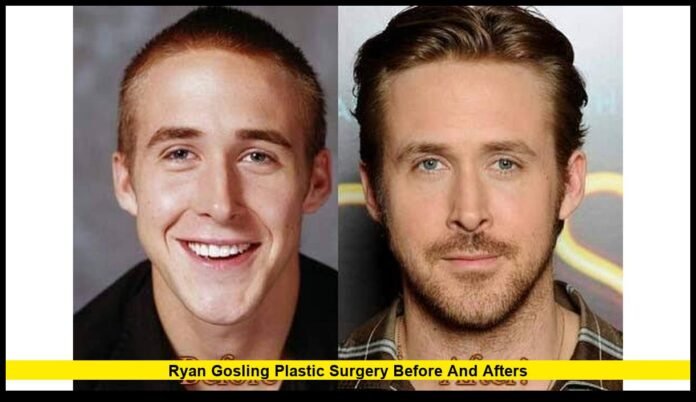 ryan gosling plastic surgery before and afters Examining the Facts Behind the Long-Running Rumors