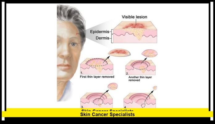 skin cancer specialists