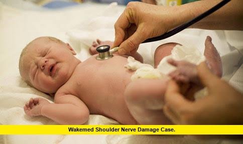 wakemed shoulder nerve damage case. wakemed shoulder nerve damage case
