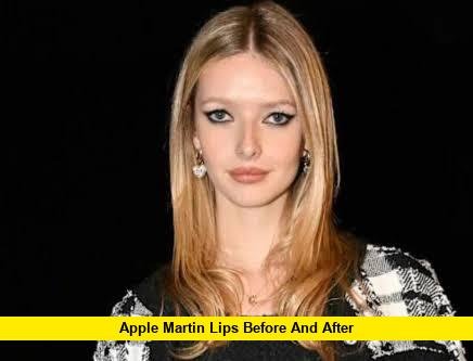 Apple Martin Lips Before and After