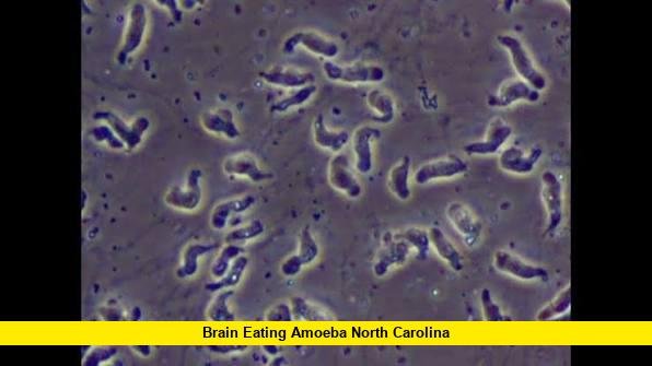 Brain-Eating Amoeba North Carolina
