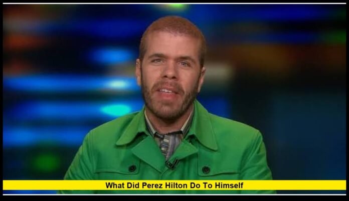 What did Perez Hilton do to himself What did Perez Hilton do to himself