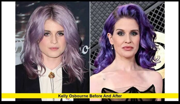 kelly osbourne before and after