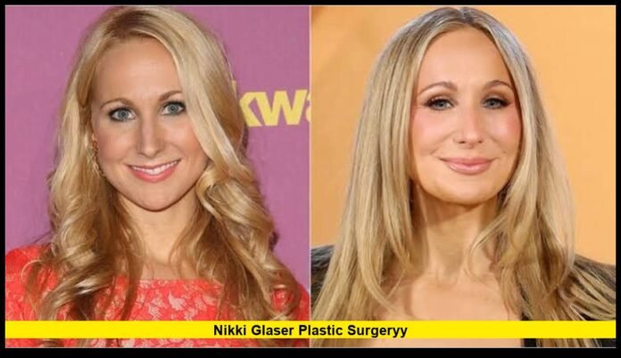 nikki glaser plastic surgeryy What She Has Revealed About Botox, Fillers and Her 2026 Facelift Plans