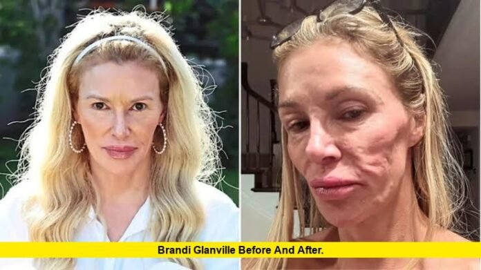 Brandi Glanville Before and After. Brandi Glanville Before and After