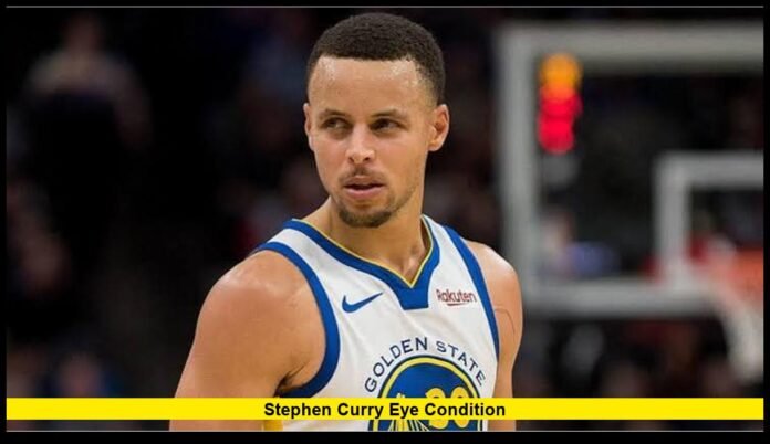 Stephen Curry eye condition