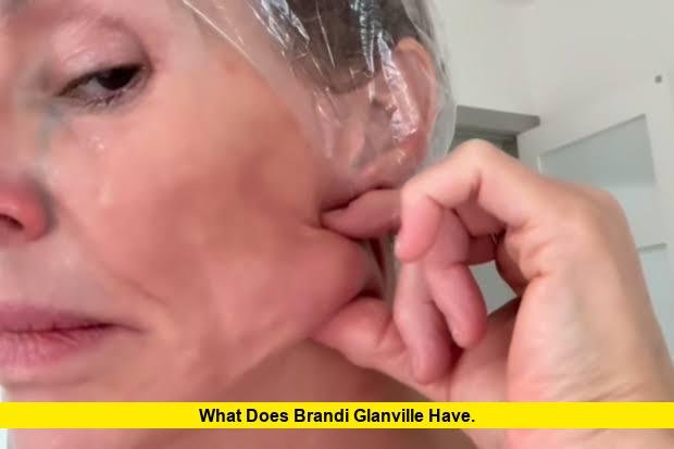 What Does Brandi Glanville Have
