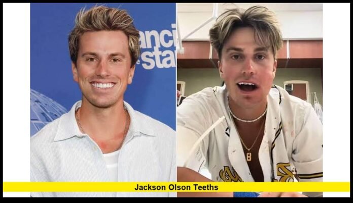 The Baseball Injury Behind His New Smile