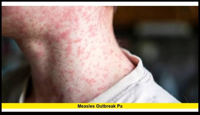 measles outbreak pa