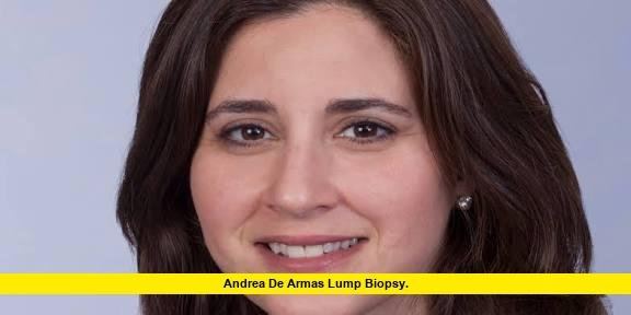 Andrea De Armas Lump Biopsy. Andrea de Armas Lump Biopsy